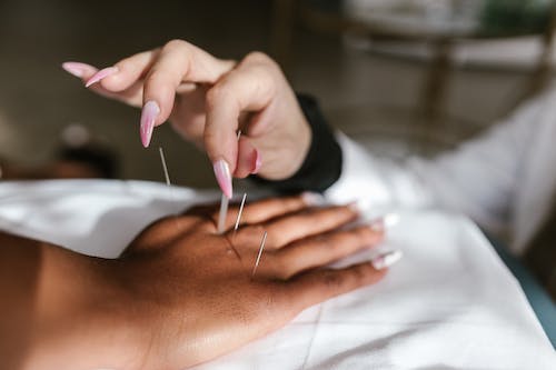 Acupuncture is a form of traditional Chinese medicine that involves inserting thin needles into specific points on the body