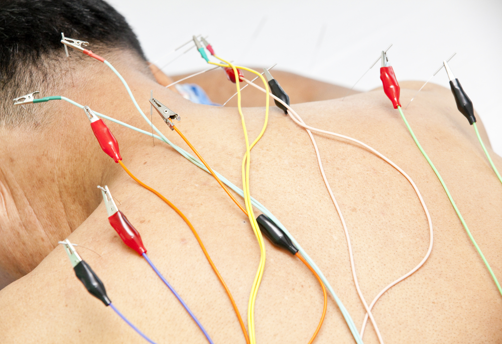 How Electro-Acupuncture Can Help with High Blood Pressure?