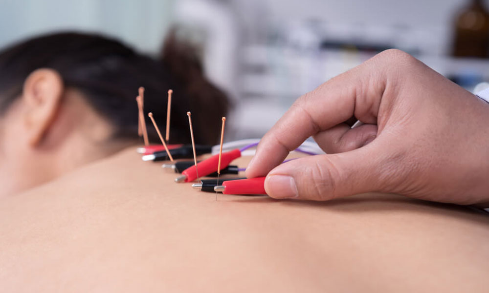 What to Expect During an Electro-Acupuncture Treatment for High Blood Pressure?